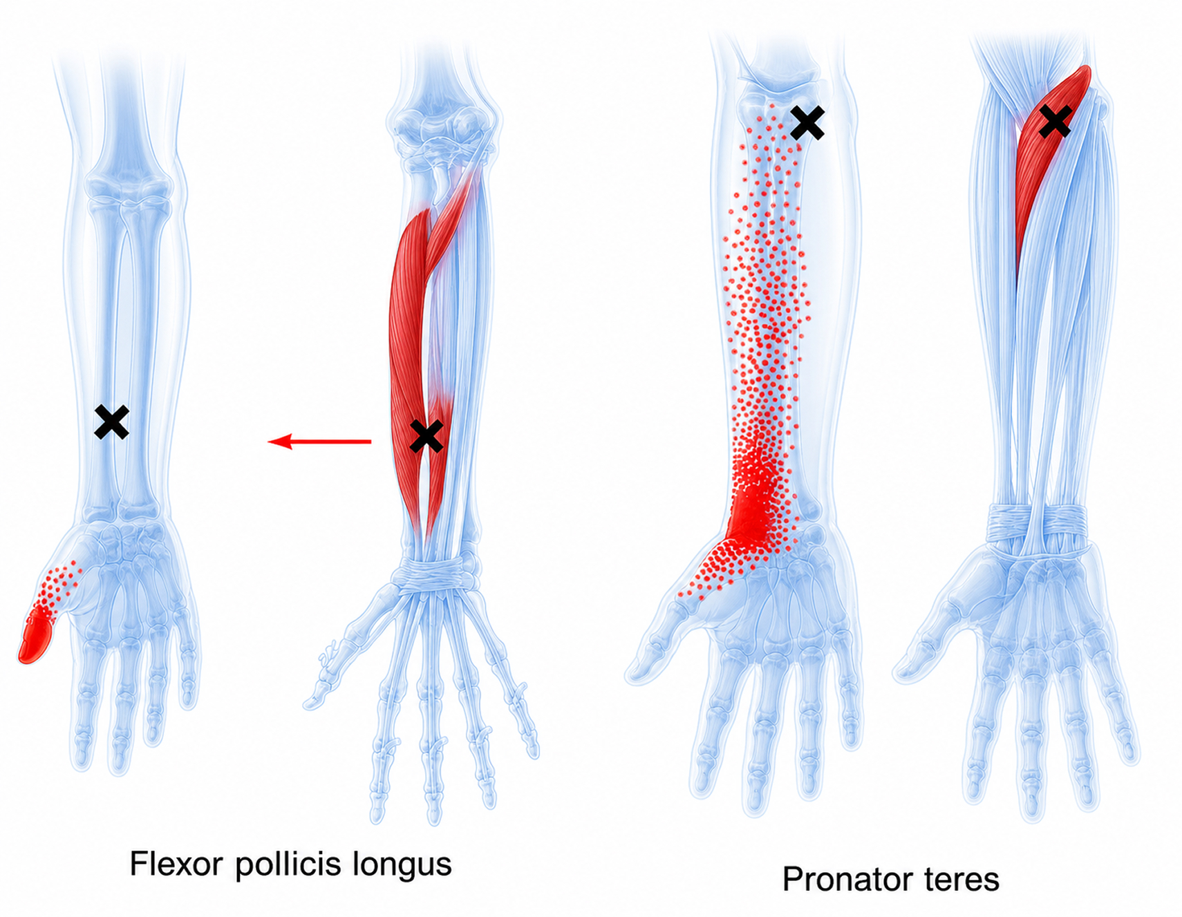 Flexor pollicis longus