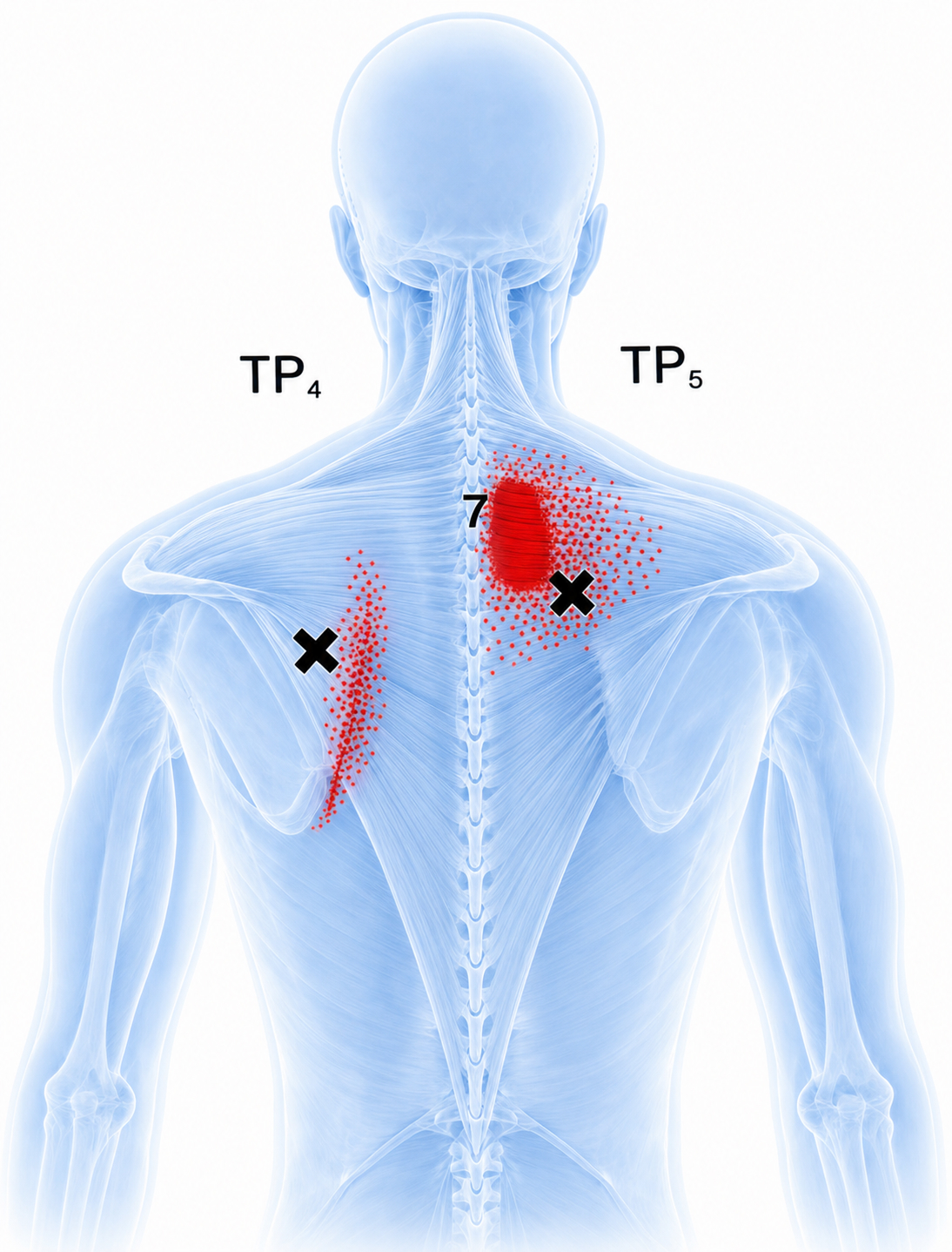 Middle trapezius