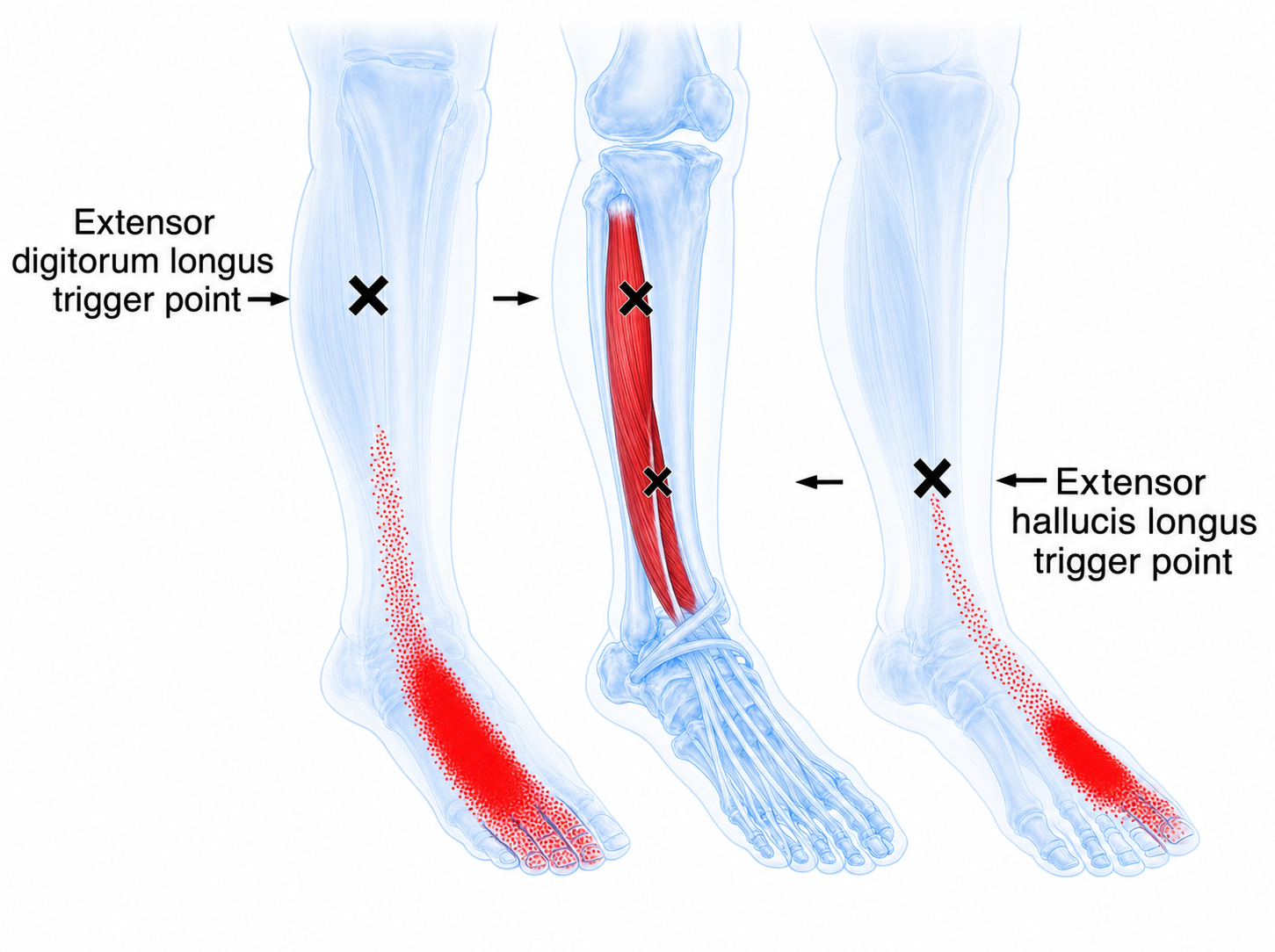Extensor digitorum longus