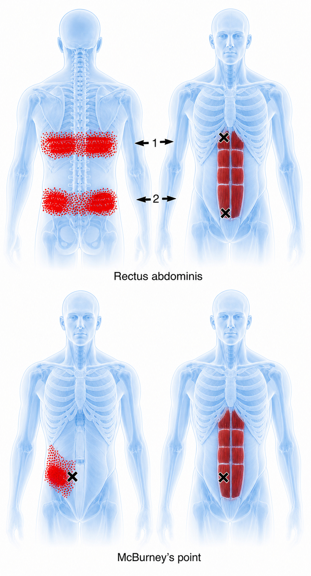 Rectus abdominis
