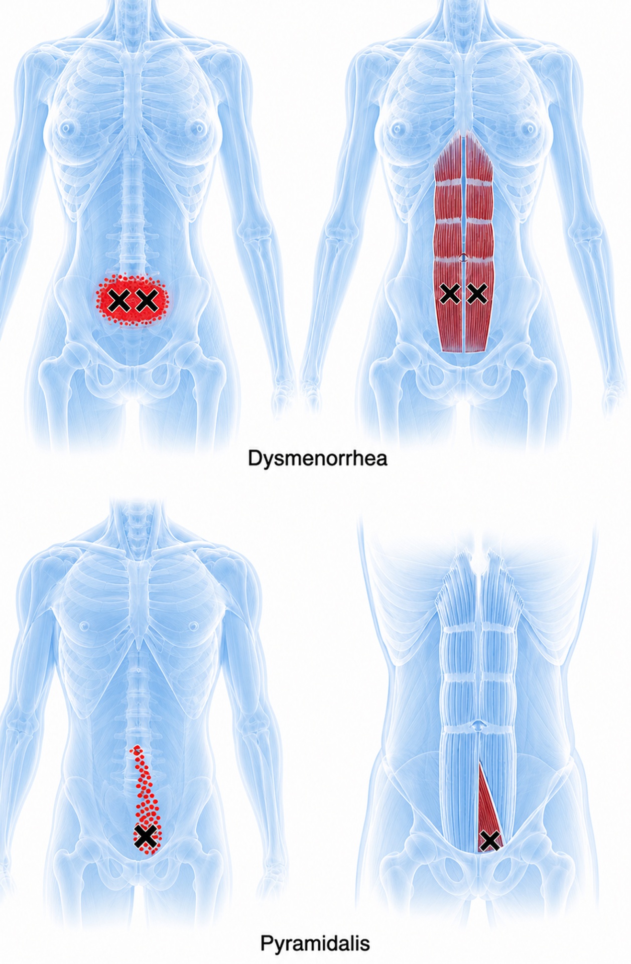 Rectus abdominis