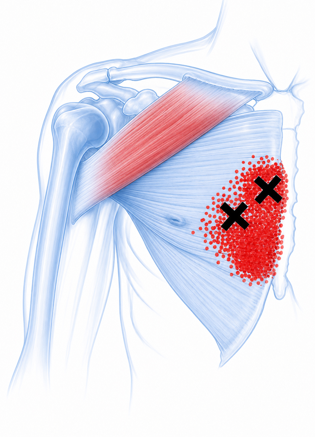 Pectoralis major