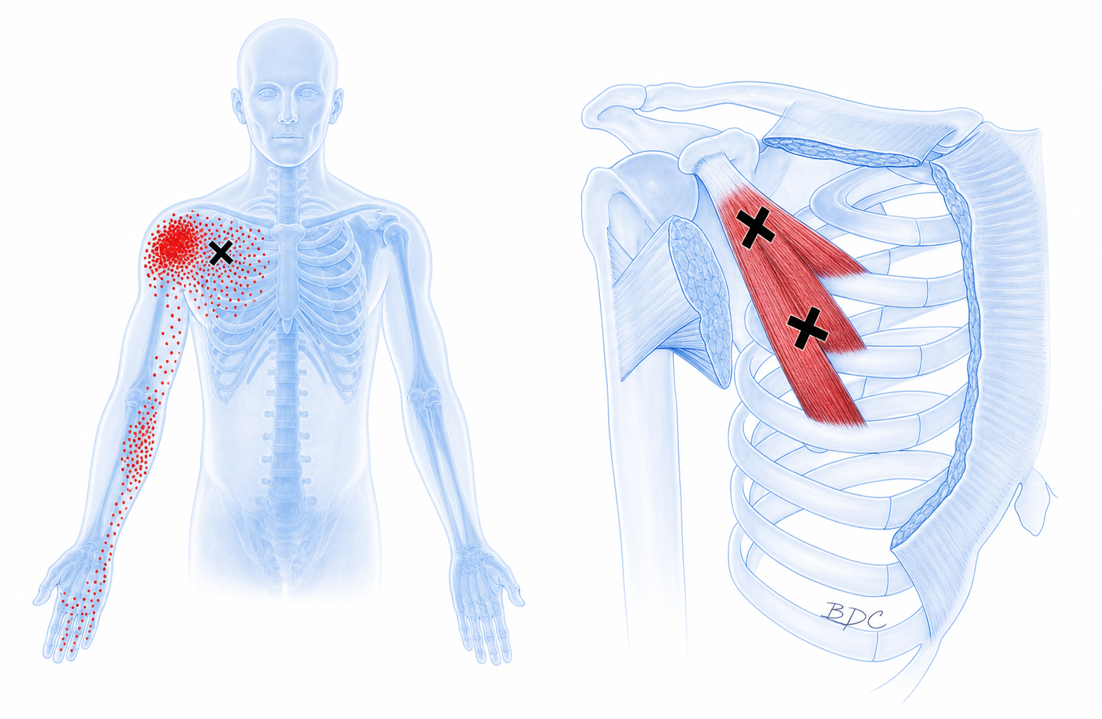 Pectoralis minor