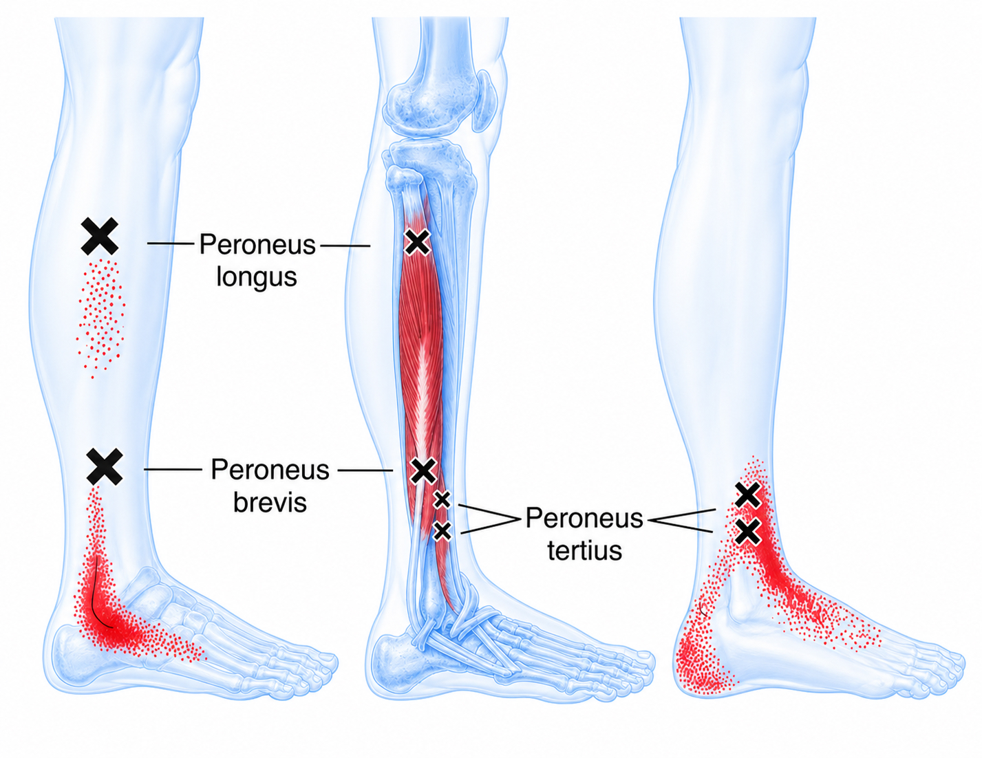Peroneus longus