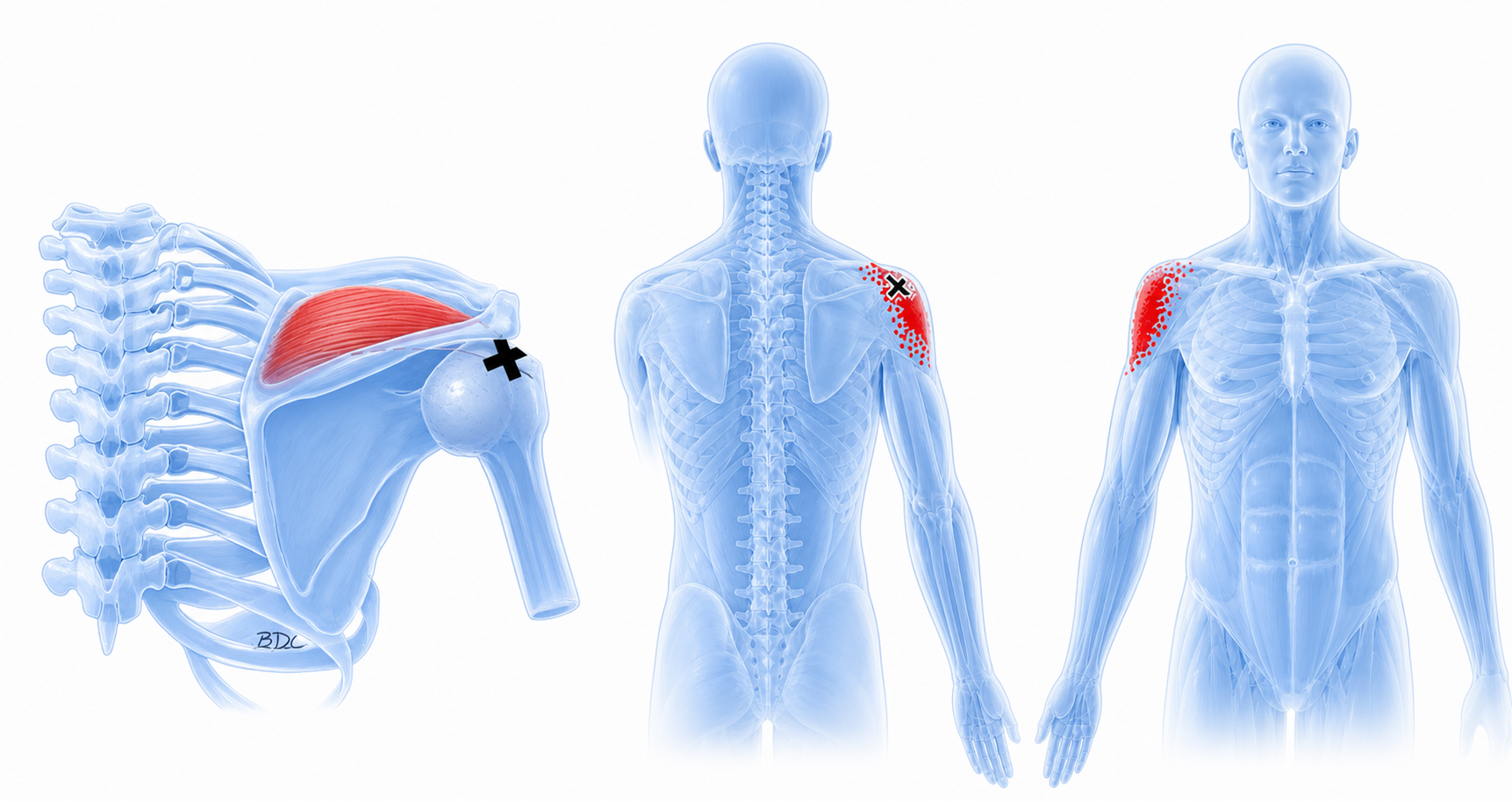 Supraspinatus