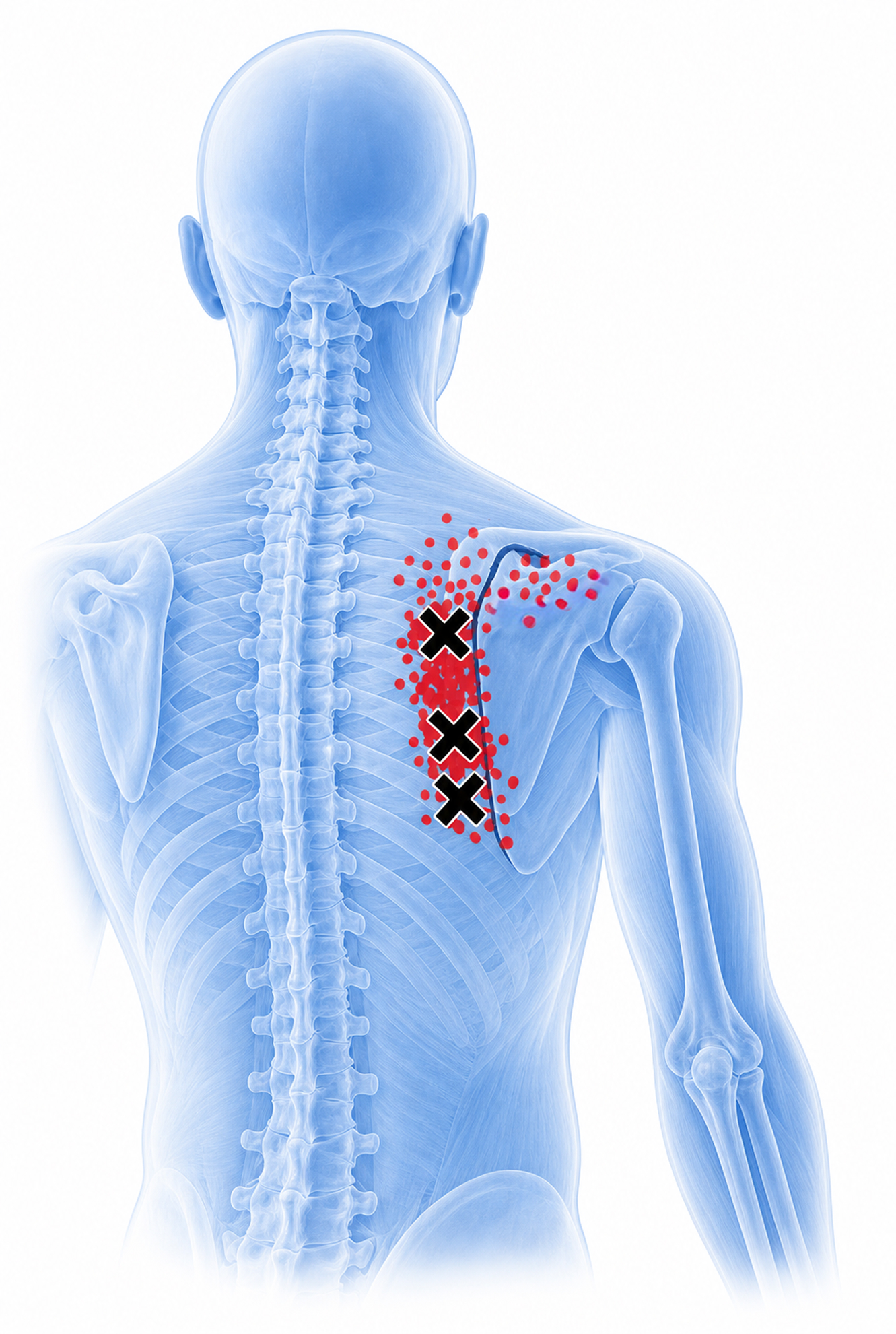 Rhomboid major