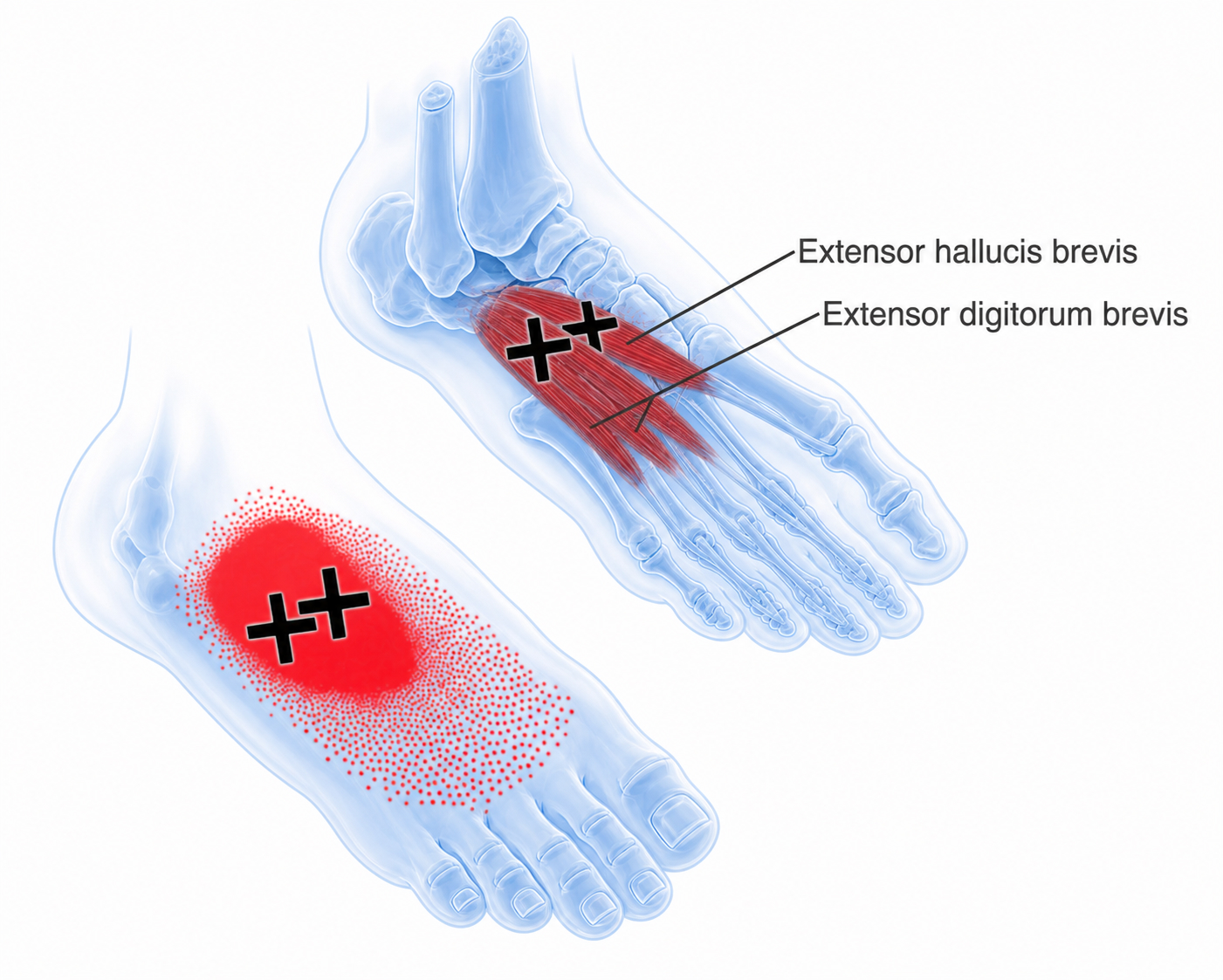 Extensor digitorum brevis
