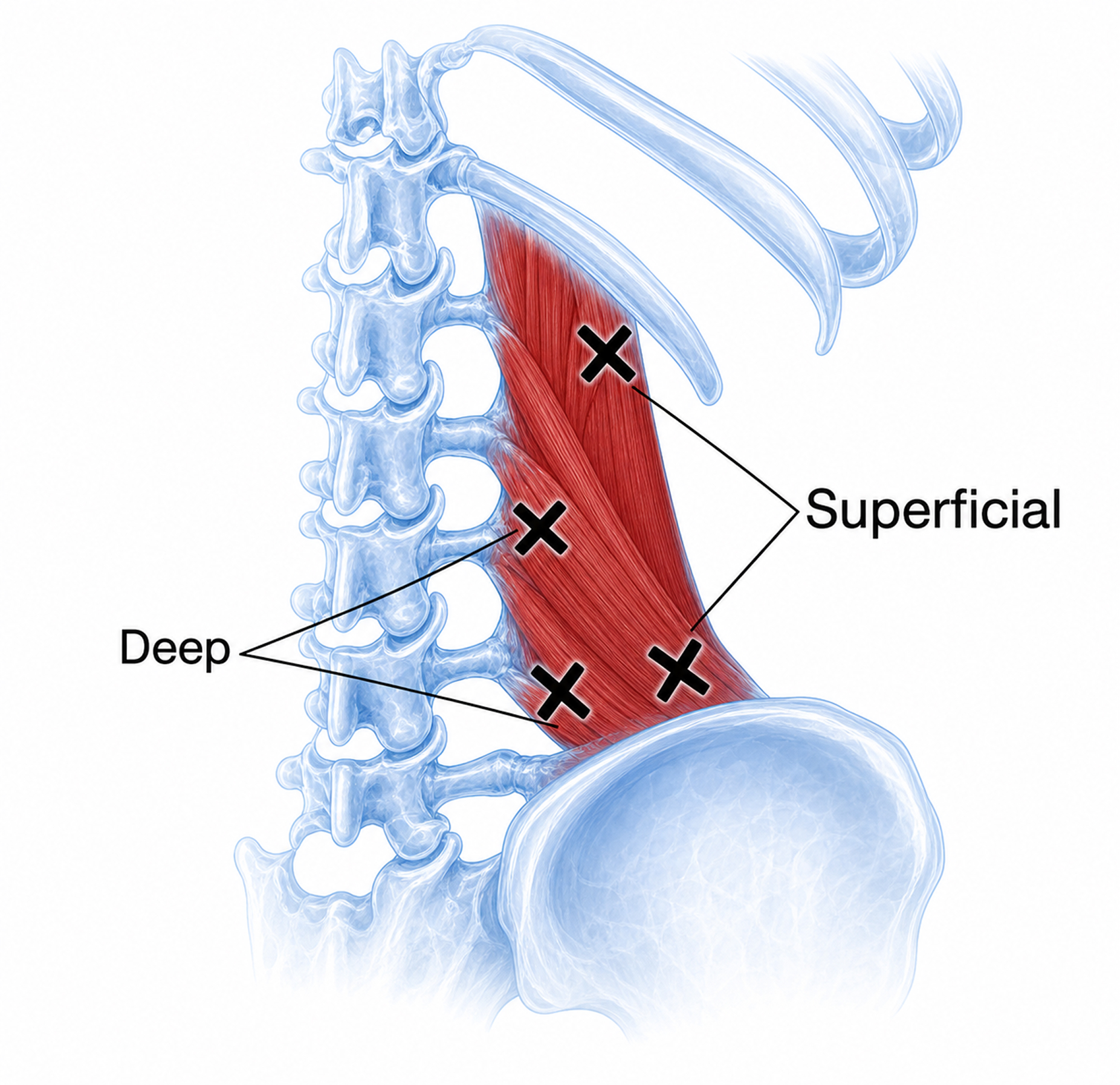 Cuadrado lumbar