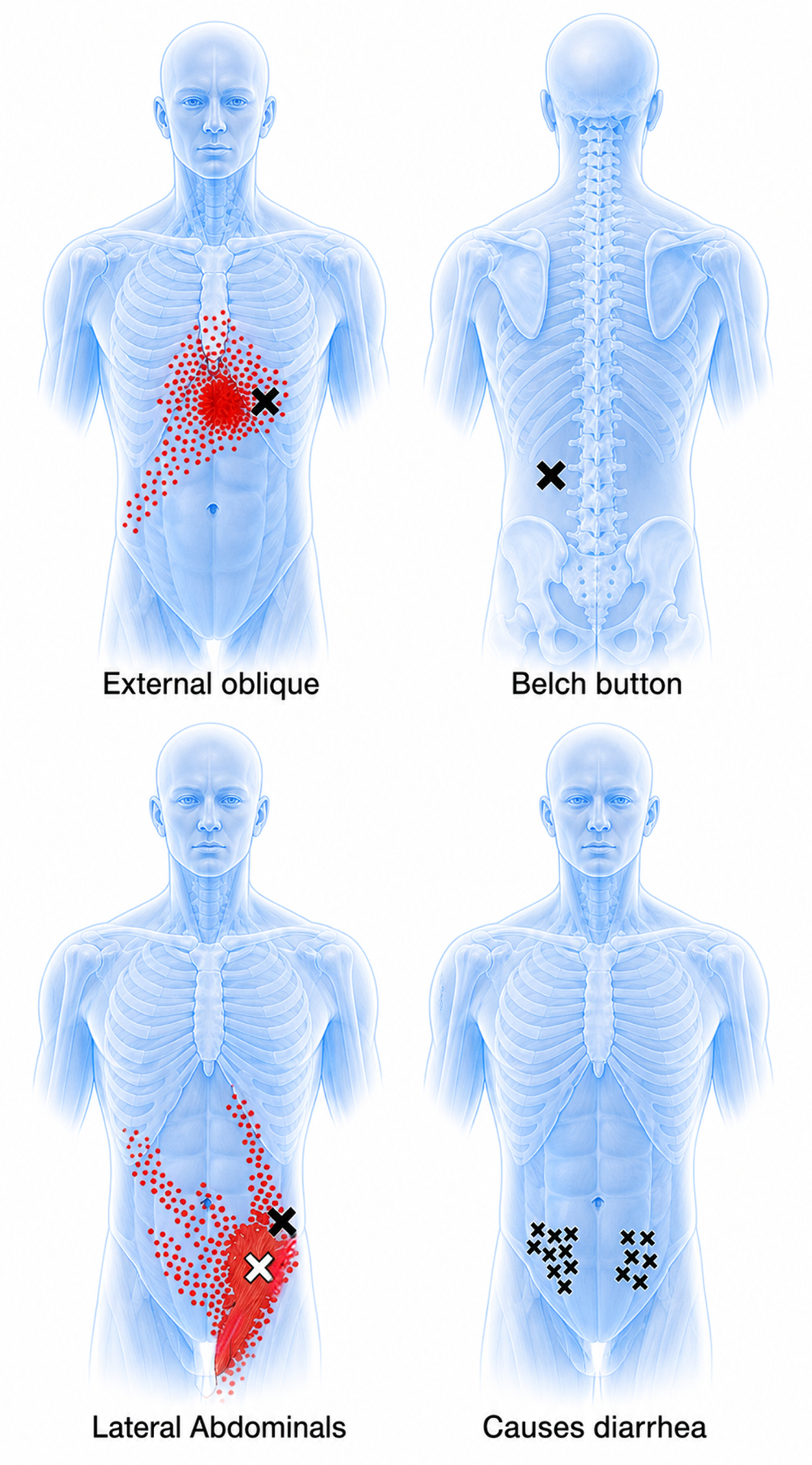 External oblique