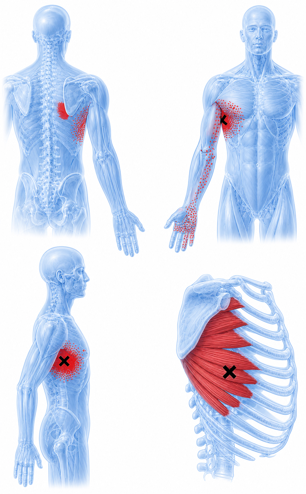Serratus anterior