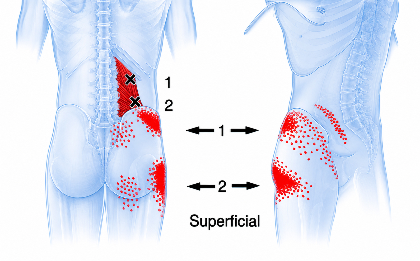 Cuadrado lumbar