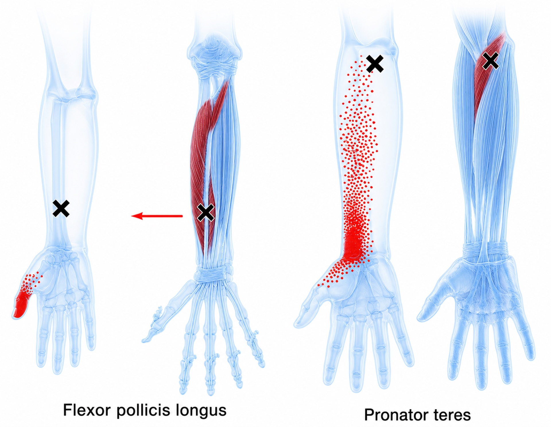 Flexor pollicis longus