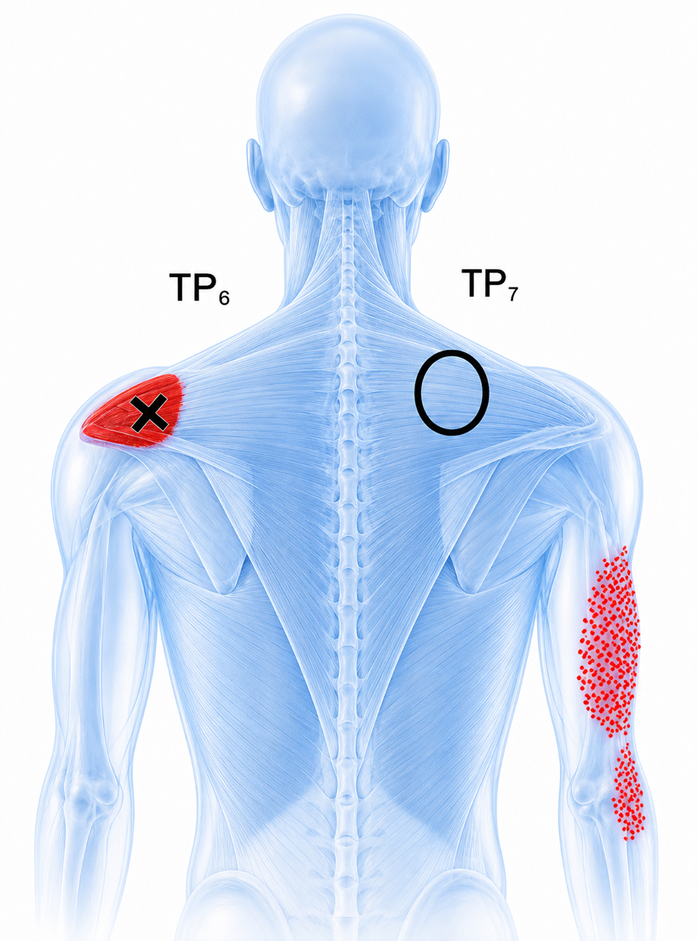 Lower trapezius