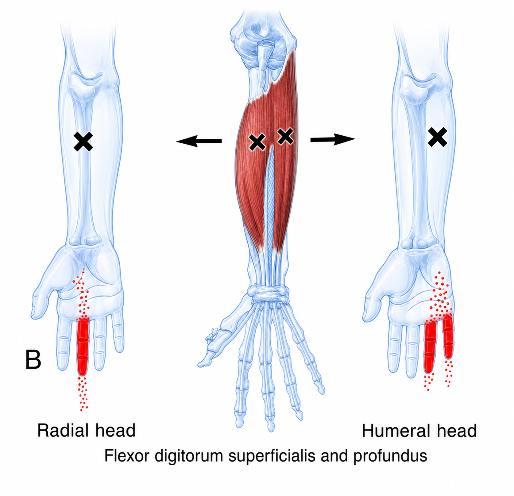 Flexor digitorum superficialis