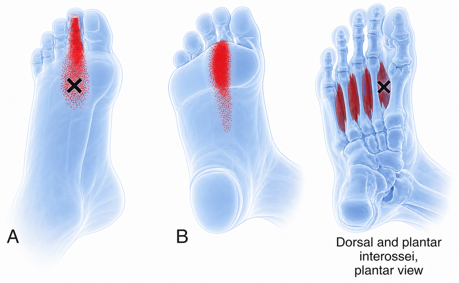 Foot interossei