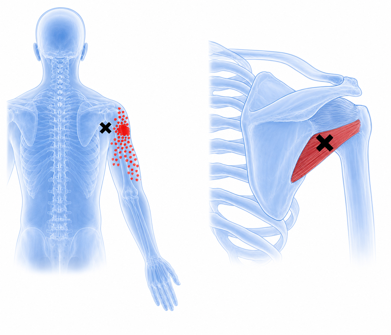 Teres minor