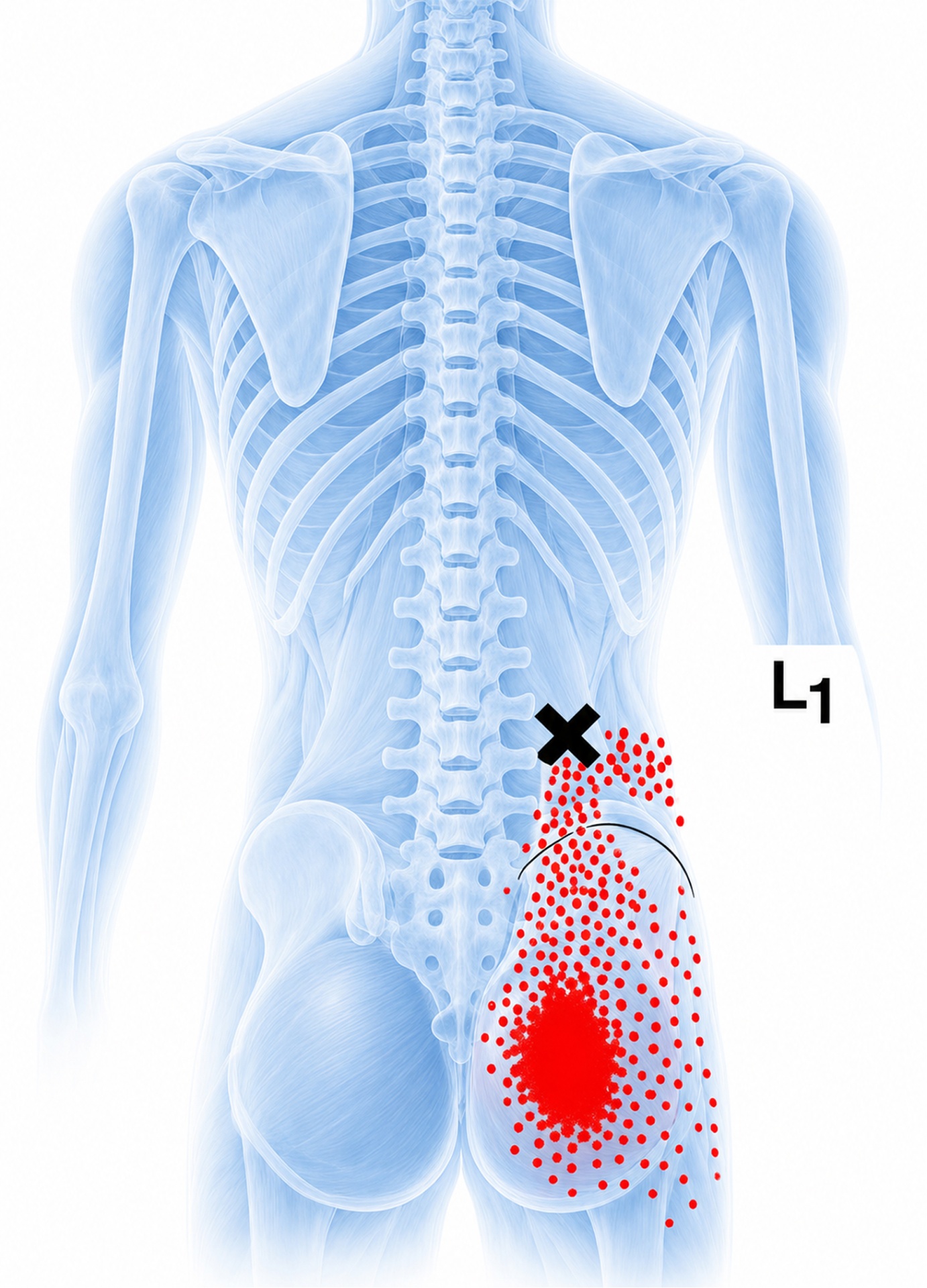 Iliocostalis lumborum