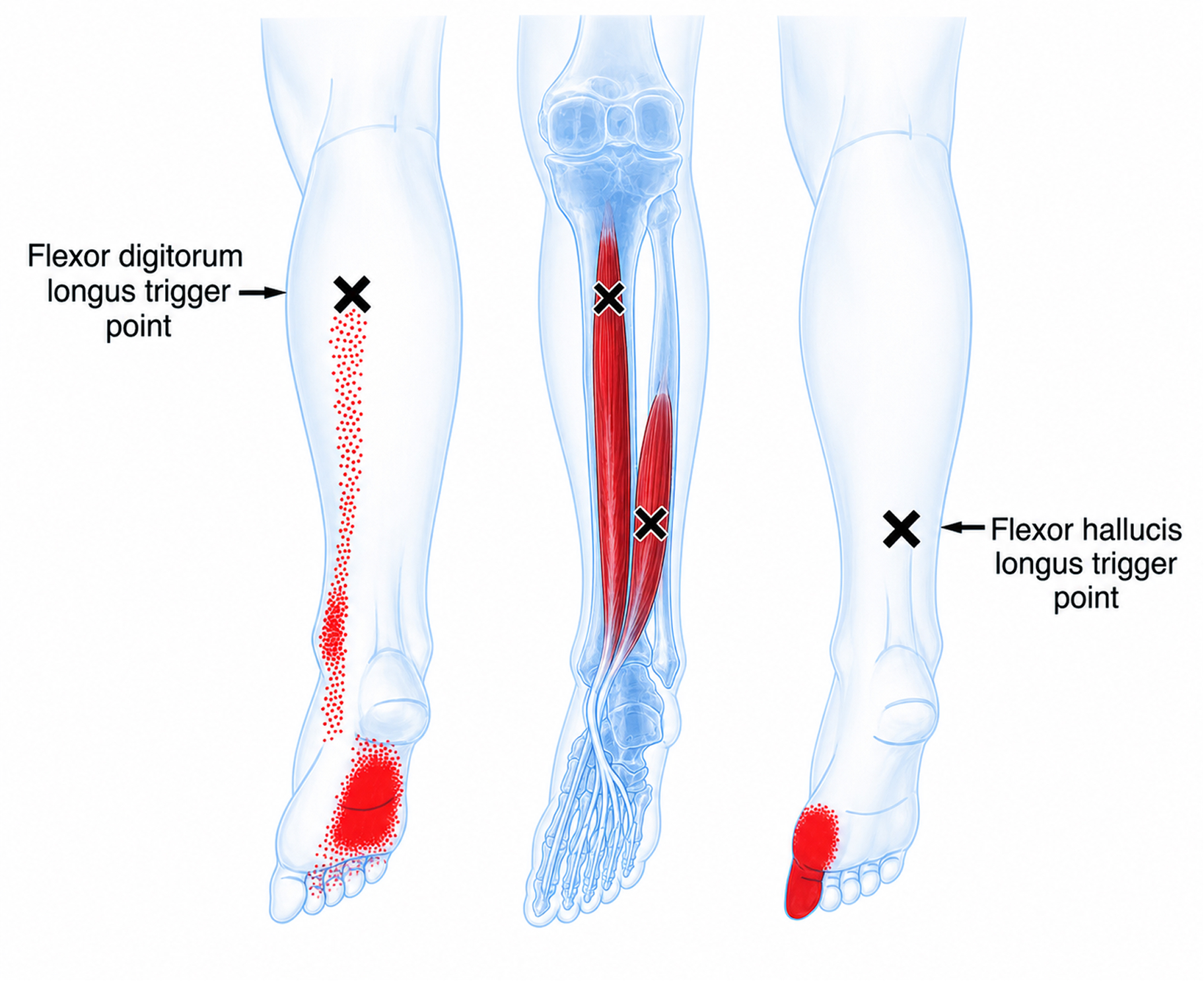 Flexor digitorum longus
