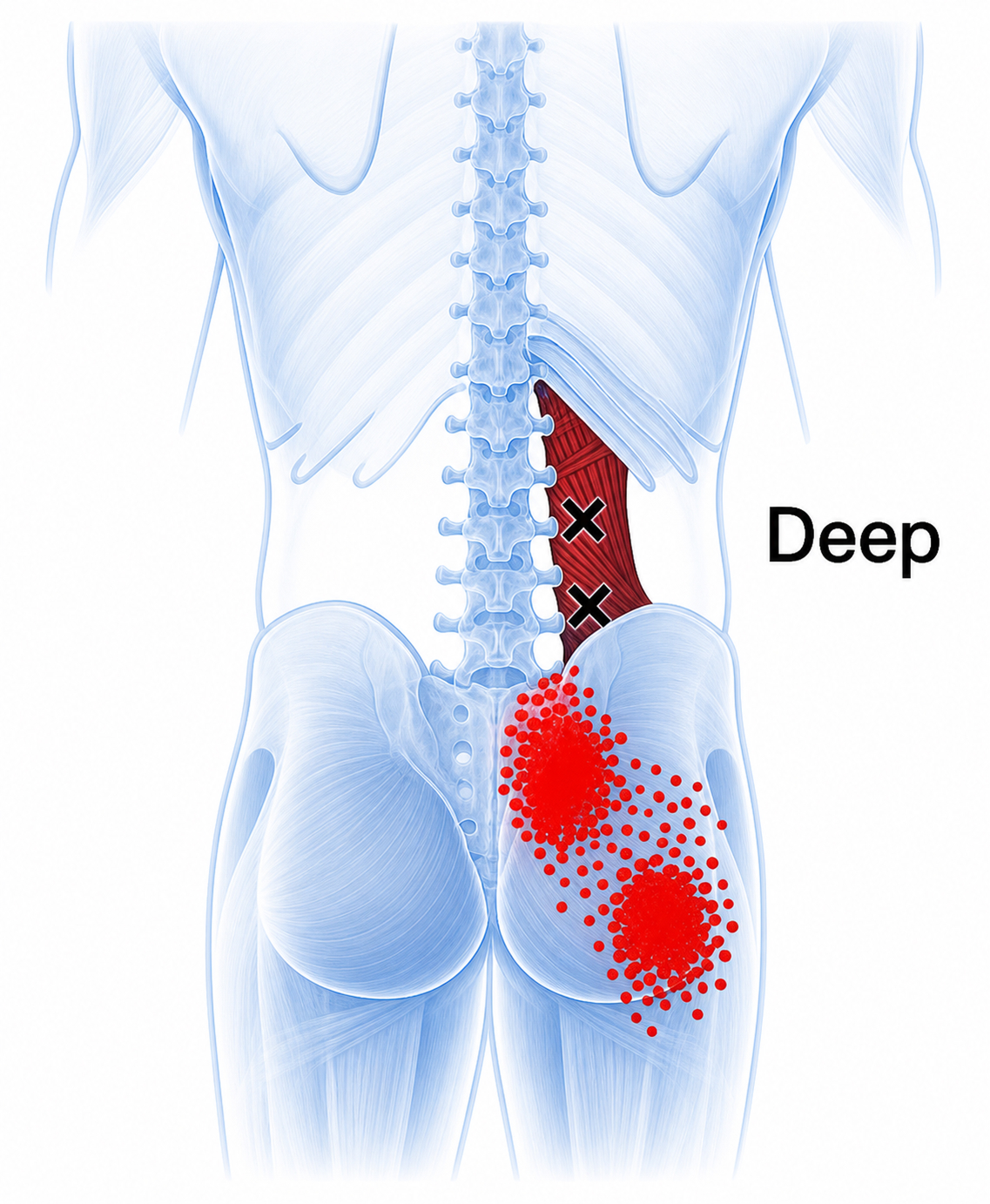 Cuadrado lumbar